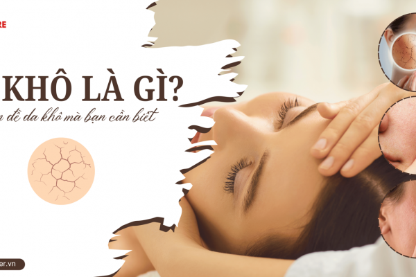 Da khô là gì? Các vấn đề của da khô bạn cần biết